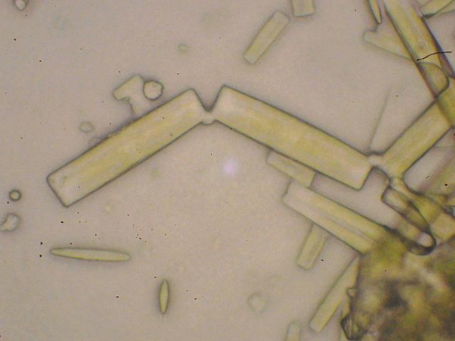 Algae bacterial mat of naviculoid diatoms on Lucernariopsis cruxmelitensis Microalgae images